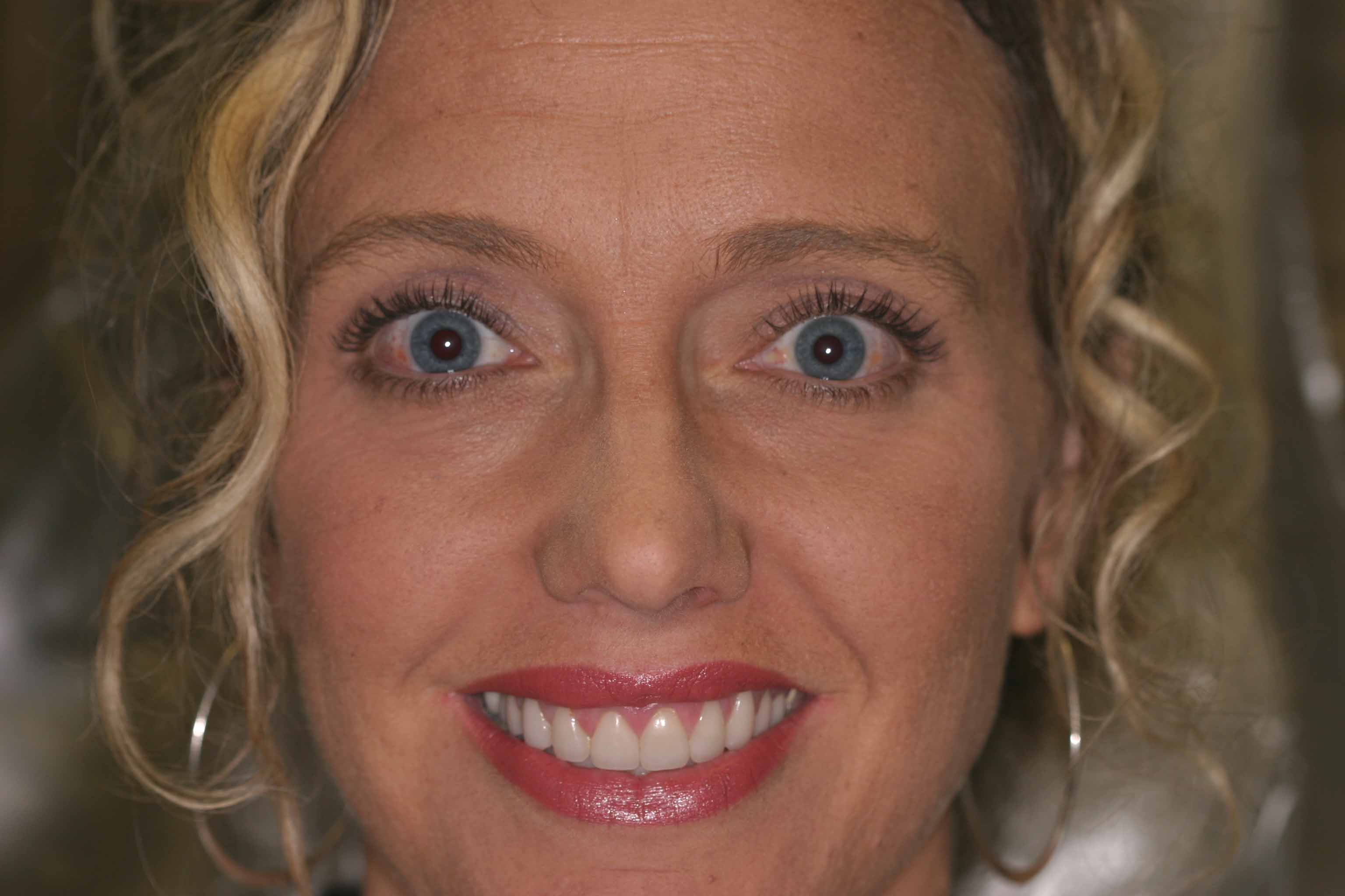 Cosmetic Dentist Fort Myers Cape Coral Naples FL